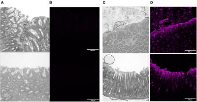 Ferric quinate (QPLEX) inhibits the interaction of major outer membrane protein (MOMP) with the Lewis b (Leb) antigen and limits Campylobacter colonization in broilers